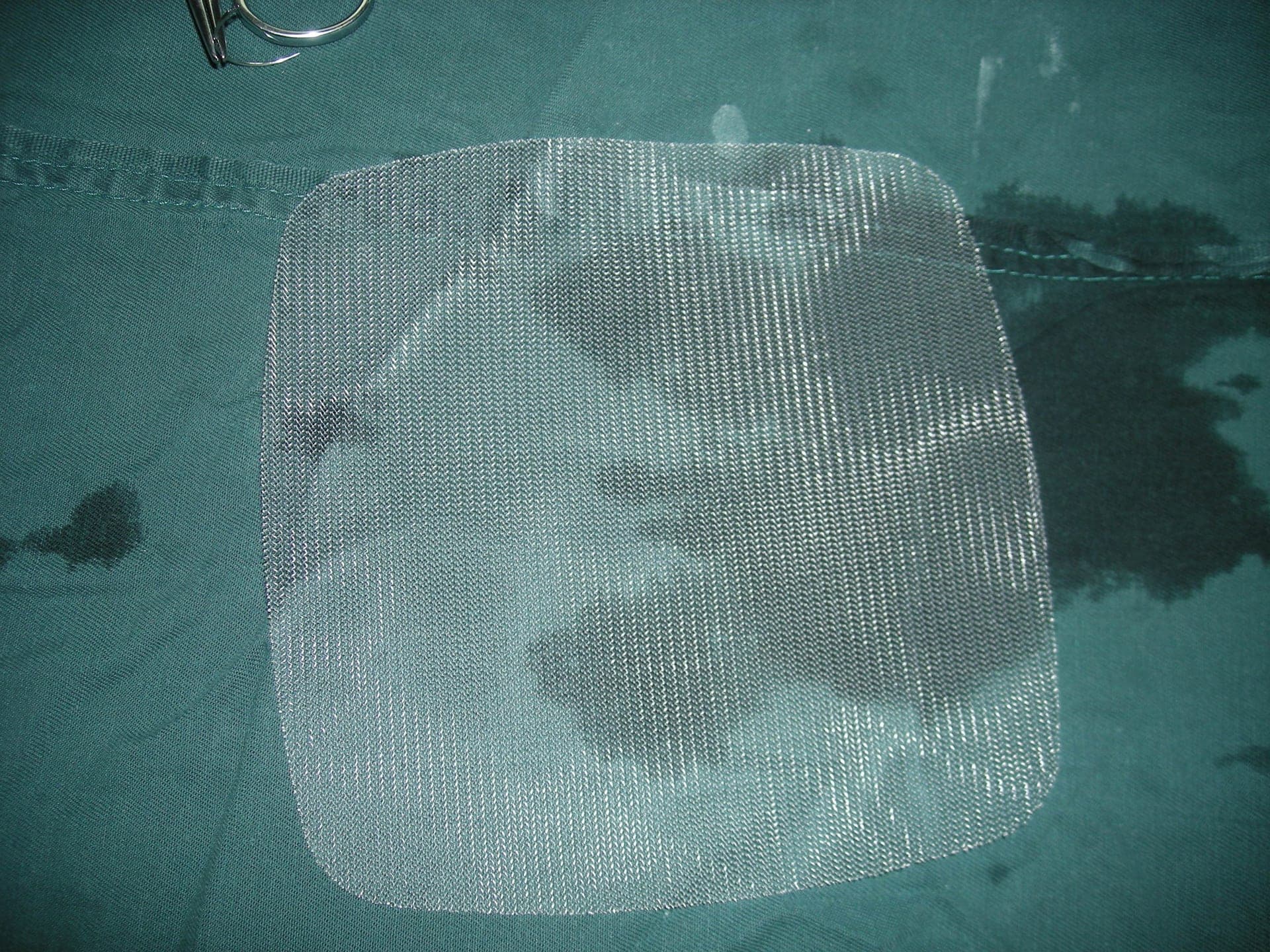 A polypropylene surgical hernia mesh patch on a plain background